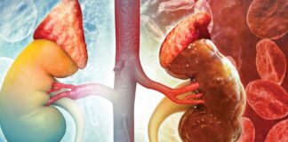 Alarming rise in kidney disease hits North-East: 1 in 30 residents affected Kidney disease